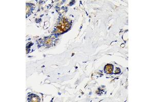 Immunohistochemistry of paraffin-embedded human breast using Mammaglobin A Rabbit mAb (ABIN7270186) at dilution of 1:100 (40x lens). (Mammaglobin A anticorps)