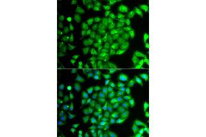 Immunofluorescence analysis of A549 cell using MEOX1 antibody. (MEOX1 anticorps)