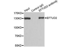 Immunoprecipitation analysis of 100ug extracts of 293T cells using 3ug EFTUD2 antibody. (EFTUD2 anticorps)