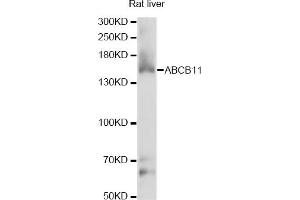 Western blot analysis of extracts of rat liver, using ABCB11 antibody (ABIN6291730) at 1:1000 dilution. (ABCB11 anticorps)
