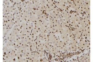 ABIN6267382 at 1/100 staining Human liver tissue by IHC-P. (BRAF anticorps  (pSer446))