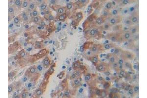 DAB staining on IHC-P; Samples: Rat Liver Tissue (CAPN1 anticorps  (AA 75-356))