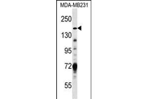 TSC1 Antibody (Center) (ABIN652207 and ABIN2840760) western blot analysis in MDA-M cell line lysates (35 μg/lane).