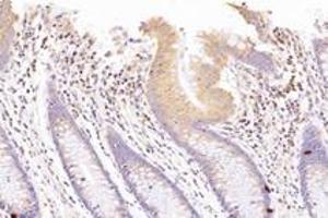 Immunohistochemistry analysis of paraffin-embedded human colon using,SUV3L1 (ABIN7075769) at dilution of 1: 1500 (SUPV3L1 anticorps)
