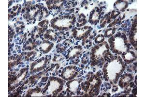 anti-CCR4-NOT Transcription Complex Subunit 4 (CNOT4) (AA 190-455) antibody