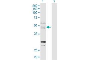 Western Blot analysis of ZNF277 expression in transfected 293T cell line by ZNF277 MaxPab polyclonal antibody. (ZNF277 anticorps  (AA 1-438))