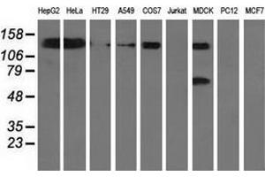 Western blot analysis of extracts (35 µg) from 9 different cell lines by using anti-L1CAM monoclonal antibody. (L1CAM anticorps)
