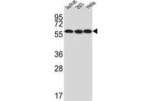 Western Blotting (WB) image for anti-UTP6, Small Subunit (SSU) Processome Component, Homolog (UTP6) antibody (ABIN3002297) (UTP6 anticorps)