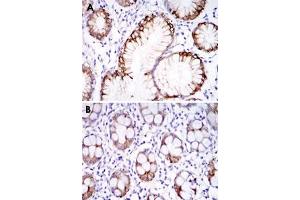 Immunohistochemical analysis of paraffin-embedded human stomach tissues (A) and colon tissues (B) using CA9 monoclonal antibody, clone 2D3  with DAB staining. (CA9 anticorps)