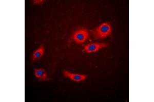 Immunofluorescent analysis of 4EBP1 staining in MCF7 cells. (eIF4EBP1 anticorps  (N-Term))
