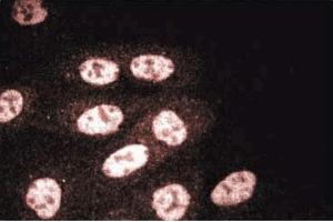 MDCK (RUVBL2 anticorps  (AA 180-228))