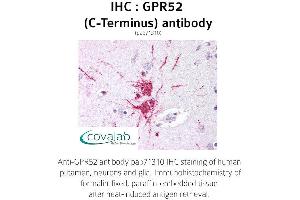 Image no. 1 for anti-G Protein-Coupled Receptor 52 (GPR52) (C-Term), (Cytoplasmic Domain) antibody (ABIN1735119) (GPR52 anticorps  (C-Term, Cytoplasmic Domain))