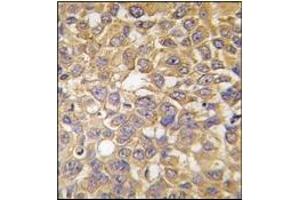 Image no. 2 for anti-Solute Carrier Family 29 (Nucleoside Transporters), Member 1 (SLC29A1) (Middle Region) antibody (ABIN5551992)