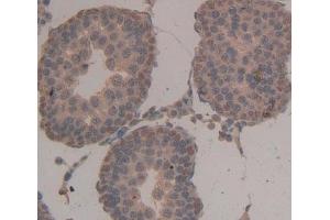 Used in DAB staining on fromalin fixed paraffin- embedded Kidney tissue