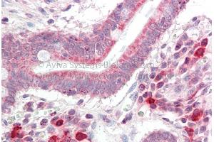 Rabbit Anti-NSMCE4A Antibody Catalog Number: ARP70964 Formalin Fixed Paraffin Embedded Tissue: Human Adult Small intestine  Observed Staining: Cytoplasm in hepatocytes Primary Antibody Concentration: 1:600 Secondary Antibody: Donkey anti-Rabbit-Cy3 Secondary Antibody Concentration: 1:200 Magnification: 20X Exposure Time: 0. (NSMCE4A anticorps  (C-Term))