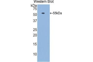 Western blot analysis of the recombinant protein. (Laminin beta 1 anticorps  (AA 1053-1258))