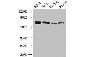 Western Blot Positive WB detected in: PC-3 whole cell lysate, Hela whole cell lysate, Mouse kidney tissue, Mouse brain tissue All lanes: GPI antibody at 2.