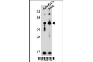 Western blot analysis in MDA-MB231,Jurkat cell line lysates (35ug/lane).