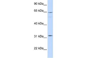 ARHGAP25 antibody used at 1 ug/ml to detect target protein. (ARHGAP25 anticorps  (Middle Region))