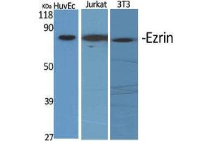 Western Blot (WB) analysis of specific cells using Ezrin Polyclonal Antibody.