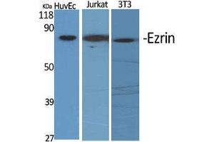 Western Blot (WB) analysis of specific cells using Ezrin Polyclonal Antibody. (Ezrin anticorps  (C-Term))
