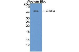 Western Blotting (WB) image for anti-Interleukin 18 Receptor Accessory Protein (IL18RAP) (AA 310-451) antibody (ABIN1862748)