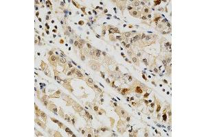 Immunohistochemistry of paraffin-embedded human stomach using CD274 antibody at dilution of 1:200 (x400 lens) (PD-L1 anticorps)
