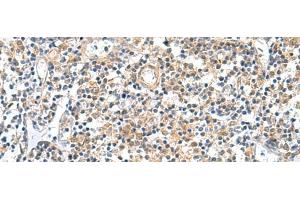 Immunohistochemistry of paraffin-embedded Human tonsil tissue using GEMIN7 Polyclonal Antibody at dilution of 1:50(x200) (GEMIN7 anticorps)