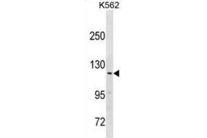 Western Blotting (WB) image for anti-Hect Domain and RLD 3 (HERC3) antibody (ABIN3000995) (HERC3 anticorps)