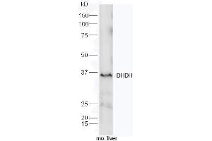 Mouse liver lysates probed with Rabbit Anti-DHDH Polyclonal Antibody, Unconjugated (ABIN2559590) at 1:300 overnight at 4˚C. (DHDH anticorps  (AA 281-334))