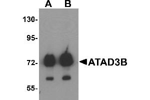 Western blot analysis of ATAD3B in human kidney tissue lysate with ATAD3B antibody at (A) 1 and (B) 2 µg/mL . (ATAD3B anticorps  (C-Term))