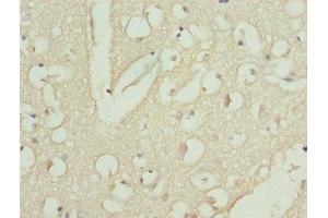 Immunohistochemistry of paraffin-embedded human brain tissue using ABIN7146436 at dilution of 1:100 (CAMK1D anticorps  (AA 1-180))