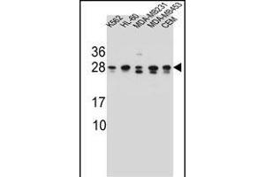 RAB3D Antibody (C-term) (ABIN657140 and ABIN2846278) western blot analysis in K562,HL-60,MDA-M,MDA-M,CEM cell line lysates (35 μg/lane). (RAB3D anticorps  (C-Term))