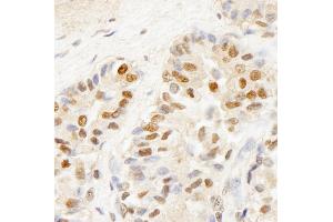 Immunohistochemistry (IHC) image for anti-BRF1, RNA polymerase III transcription initiation factor subunit (BRF1) (AA 627-677) antibody (ABIN7448445)