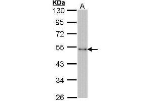 WB Image Sample (30 ug of whole cell lysate) A: Hela 10% SDS PAGE antibody diluted at 1:1000 (CTBP1 anticorps  (Center))