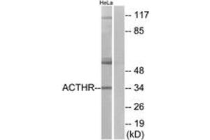 Western blot analysis of extracts from HeLa cells, using ACTHR Antibody. (MC2R anticorps  (AA 248-297))