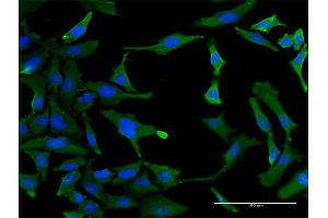 Immunofluorescence of monoclonal antibody to SF3B2 on HeLa cell. (SF3B2 anticorps  (AA 1-636))