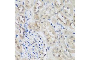 Immunohistochemistry of paraffin-embedded rat kidney using UBE3A antibody at dilution of 1:200 (40x lens). (ube3a anticorps)