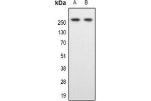 Western blot analysis of SPTBN1 expression in Hela (A), Colo205 (B) whole cell lysates. (SPTBN1 anticorps)