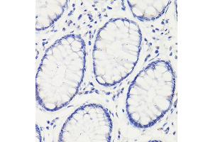 Immunohistochemistry of paraffin-embedded mouse stomach using GAPDH Mouse mAb (ABIN3020540, ABIN3020541, ABIN3020542 and ABIN1512934) at dilution of 1:100 (40x lens). (GAPDH anticorps)