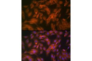 Immunofluorescence analysis of C6 cells using Calpain 1 Rabbit mAb (ABIN7266033) at dilution of 1:100 (40x lens). (CAPNL1 anticorps)