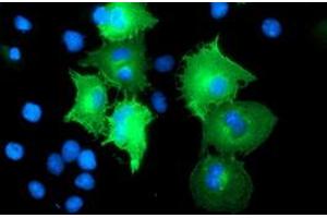 Immunofluorescence (IF) image for anti-Cerebral Cavernous Malformation 2 (CCM2) antibody (ABIN1497131) (CCM2 anticorps)
