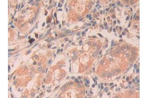 DAB staining on IHC-P; Samples: Human Stomach Tissue