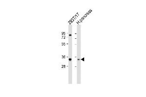 All lanes : Anti-SHOX Antibody (N-term) at 1:2000 dilution Lane 1: 293T/17 whole cell lysate Lane 2: human pancreas lysate Lysates/proteins at 20 μg per lane.