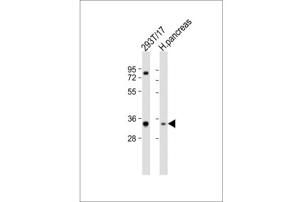 SHOX anticorps  (N-Term)