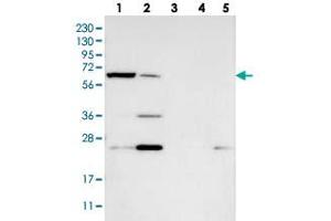 Western blot analysis of Lane 1: RT-4, Lane 2: U-251 MG, Lane 3: Human Plasma, Lane 4: Liver, Lane 5: Tonsil with KLHDC10 polyclonal antibody  at 1:250-1:500 dilution. (KLHDC10 anticorps)