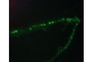 Immunofluorescence staining of a 7 days old zebrafish embryo (Desmin anticorps)