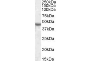 Western Blotting (WB) image for anti-Potassium Inwardly-Rectifying Channel, Subfamily J, Member 1 (KCNJ1) (Internal Region) antibody (ABIN2464210) (KCNJ1 anticorps  (Internal Region))
