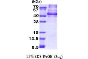 SDS-PAGE (SDS) image for Nanog Homeobox Pseudogene 8 (NANOGP8) (AA 1-305) protein (ABIN6387240) (NANOGP8 Protein (AA 1-305))
