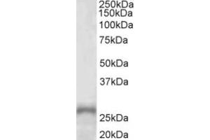 Western Blotting (WB) image for anti-Paired-Like Homeobox 2a (PHOX2A) (Internal Region) antibody (ABIN2465125)